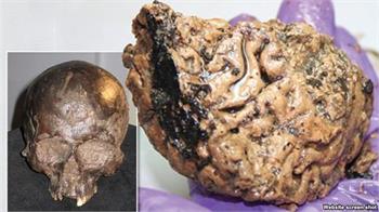بررسی بقايای مغزی مربوط به بيش از دو هزار و ۵۰۰ سال پيش
